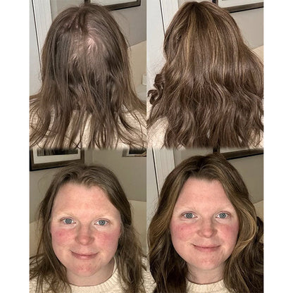⚡⚡Final Hours – 2026 New Lightweight & Breathable Wavy Hair Topper