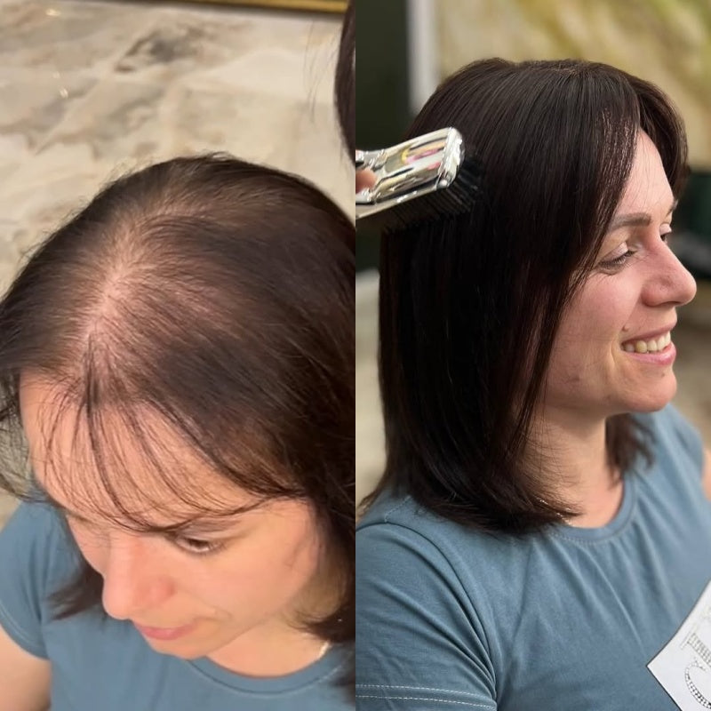 Natural Straight Hair Topper for Thinning Crown – Instant Volume & Seamless Coverage