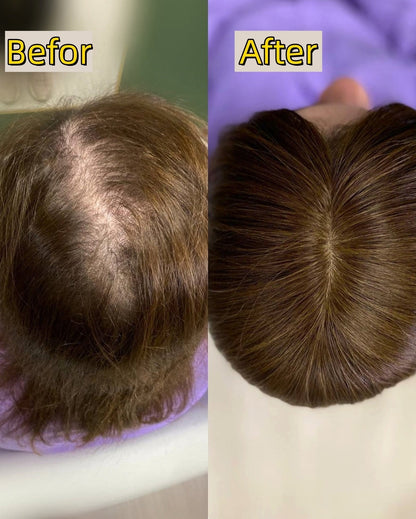 Natural Straight Hair Topper for Thinning Crown – Instant Volume & Seamless Coverage