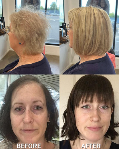 Hot Sale Straight Hair Topper With Bangs For  Women With Thinning Hair
