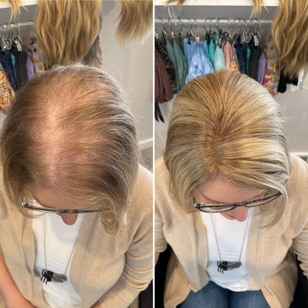 Natural Straight Hair Topper for Thinning Crown – Instant Volume & Seamless Coverage