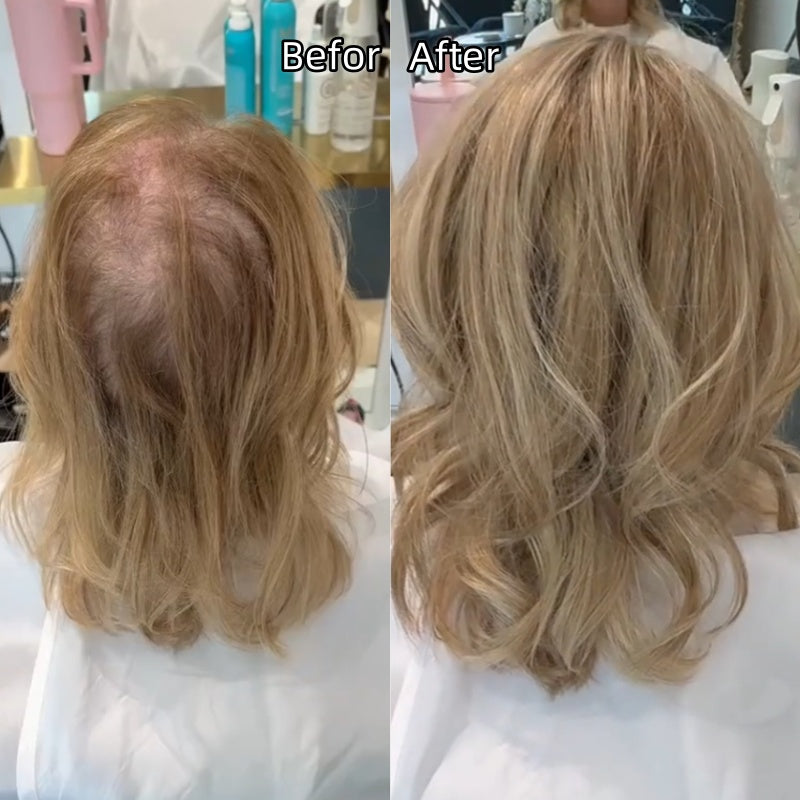⚡⚡Final Hours – 2026 New Lightweight & Breathable Wavy Hair Topper